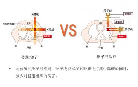 头颈部肉瘤治疗