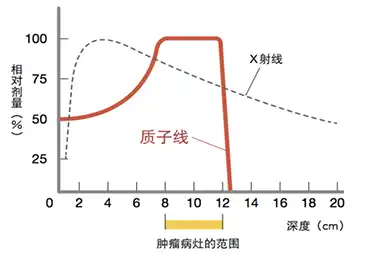 日本重离子治疗