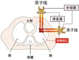 日本重离子治疗