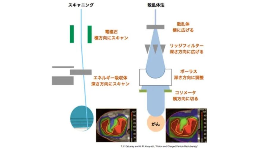 日本先进的质子治疗中心—【国立癌症研究中心东医院】