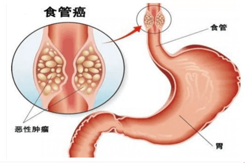 双免联合疗法