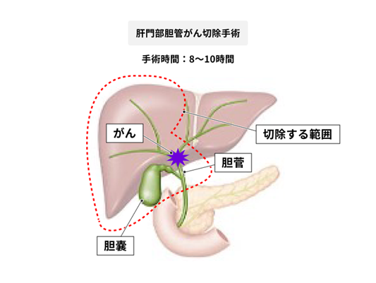 高桥祐_日本肝胆胰外科专家_癌研有明医院