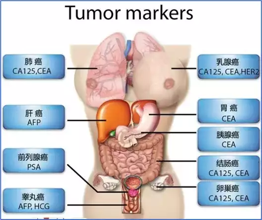 可愈有道_肿瘤标志物升高代表着什么