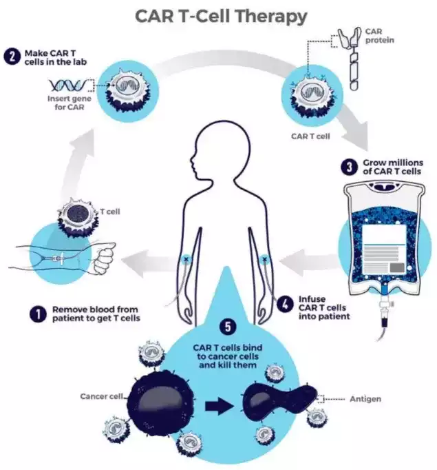 可愈有道_CAR-T细胞疗法