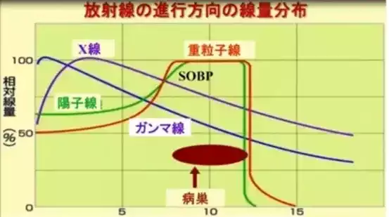 可愈有道_放射线曲线